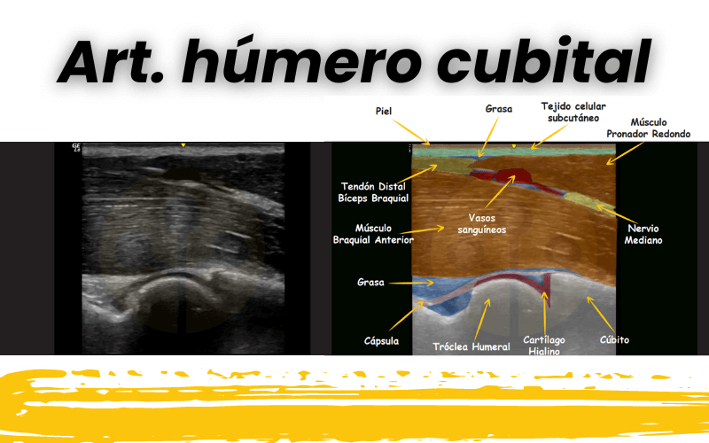 4. Ecografia codo tempo formacion.png